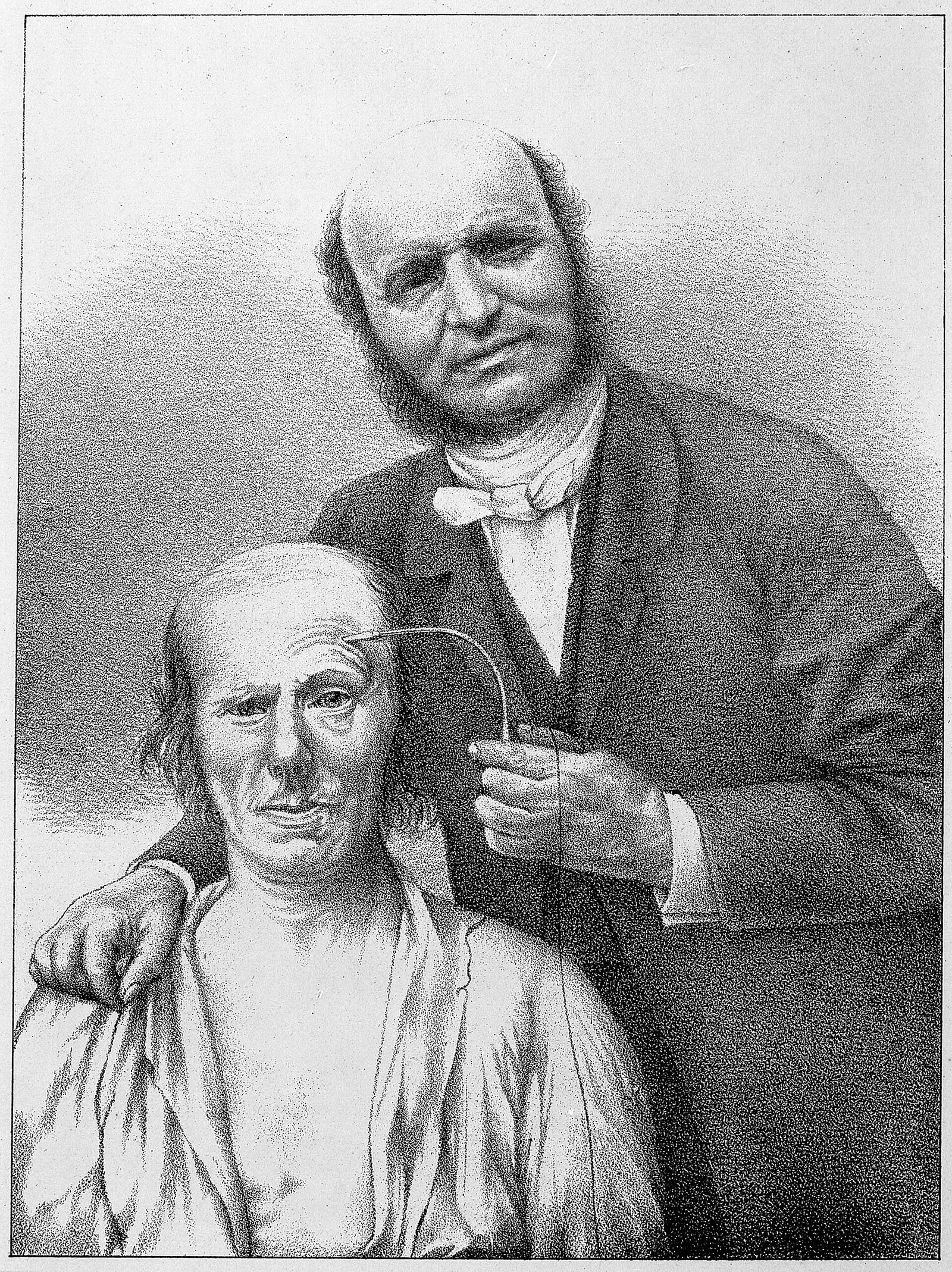 Figure 3 — Duchenne faradising the frontal muscles, from his own published plates. Two hand-held surface electrodes on the brow, a seated subject, and a physician watching which muscle answers — this is local…